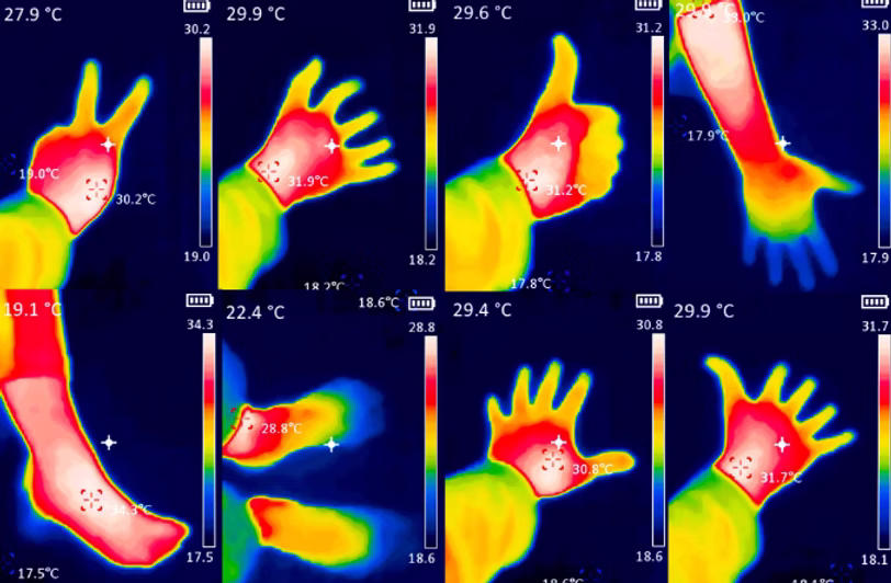 Thermography